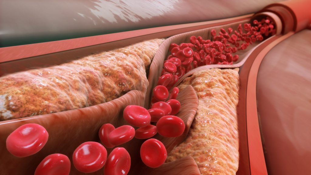 Arterie krwionośne